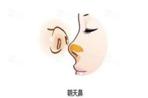 朝天鼻卡通图展示 朝天鼻卡通图展示