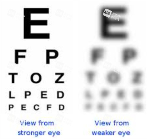 正常视力和弱视视力 正常视力和弱视视力