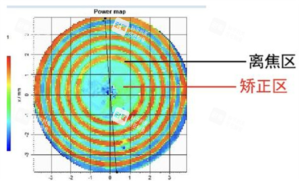 近视配镜前检查图解