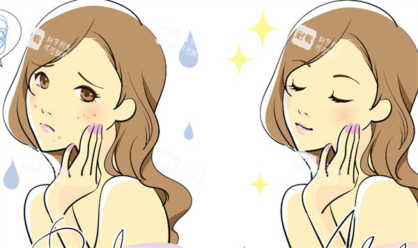 祛痘前后对比图片 祛痘前后对比图片