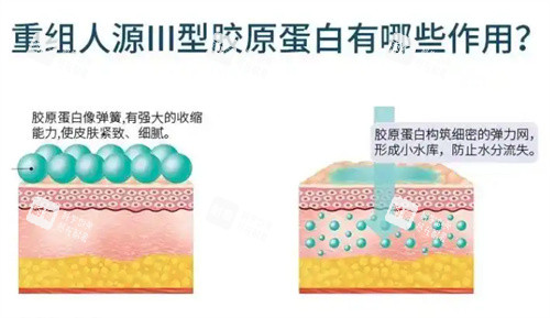 重组三型胶原蛋白有哪些作用