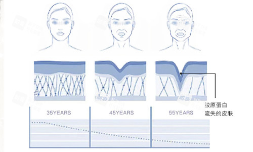 胶原蛋白流失的皮肤