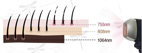 钛提升是智商税吗？深度拆解三波长激光原理：即时提拉VS长效抗衰，为什么韩国博主都在推？