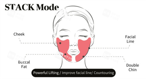 钛提升作用区域介绍