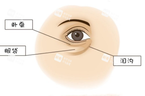 卧蚕、眼袋、泪沟展示图 卧蚕、眼袋、泪沟展示图