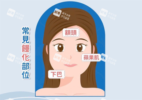 馒化脸常见部位 馒化脸常见部位