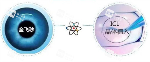 全飞秒和晶体植入 全飞秒和晶体植入