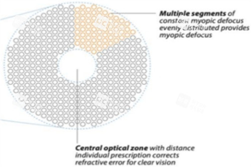 离焦镜片原理图示