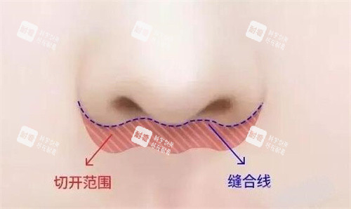 人中缩短卡通图展示