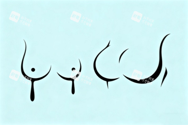 假体隆胸卡通图一览