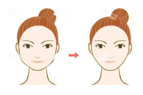 2026北京孙大山吸脂价格表全新发布：面吸6000+/5G天使光雕6000+/脂肪O型腿6.8w+