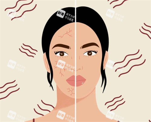 敏感肌治疗前后对比