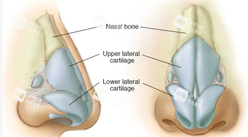 隆鼻手术动画图示