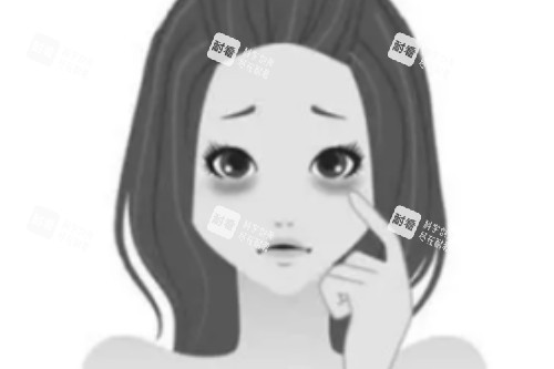 黑眼圈卡通图