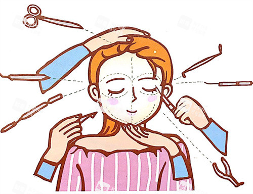 面部轮廓整形卡通图展示