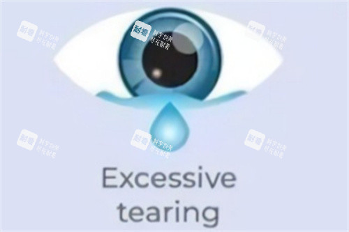 眼睛多泪示意图
