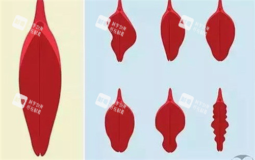 小阴唇的种类