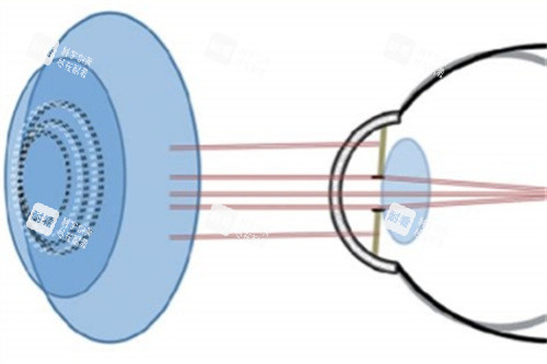 周边离焦示意图