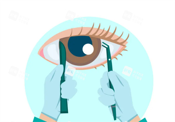 眼睛治疗卡通图展示