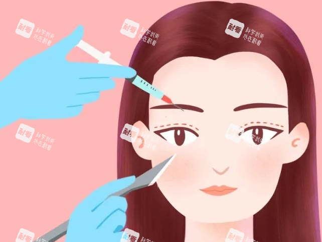 双眼皮画线展示图