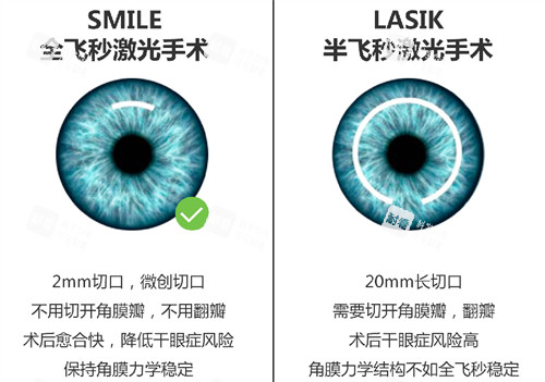 全飞半飞对比