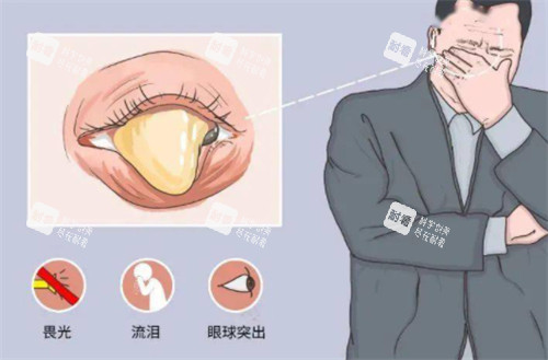 眼睑闭合不全的危害