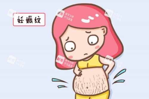 妊娠纹卡通图