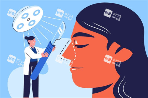 鼻部手术示意图