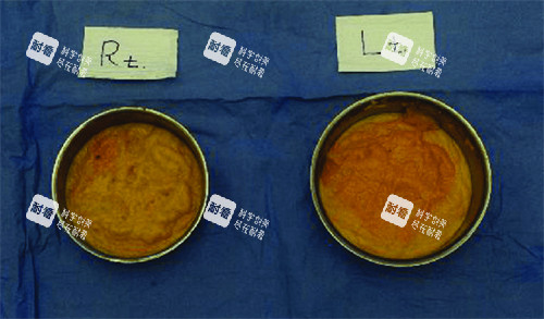 李方奇医生挂号预约攻略指南:手把手教你锁定清奥取异物大神号源