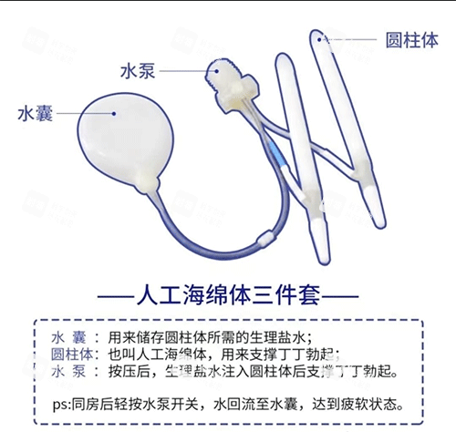 人工海绵体三件套