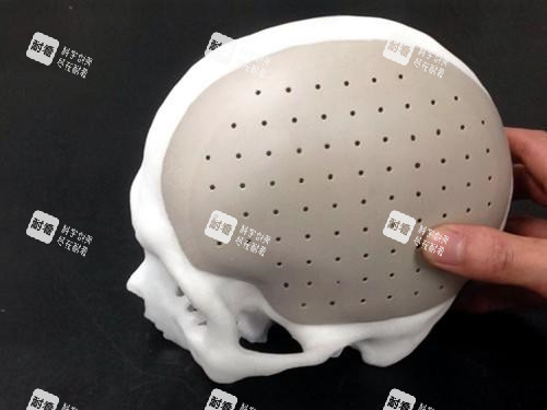 头部填充术peek展示图