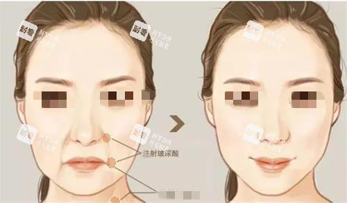 实地探访釜山格莱斯grays皮肤科：医生团队、仪器设备、项目价格，真实体验无套路分享