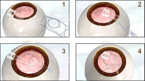 重庆西南医院眼科怎么预约挂号？电话/在线都能约，地址路线+医生介绍+患者口碑都公开