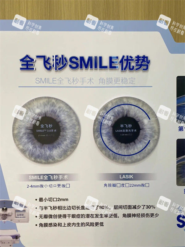 全飞秒SMILE优势