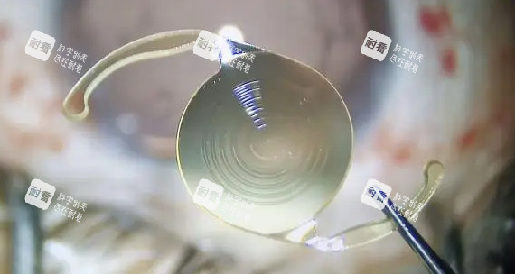 三焦点人工晶体