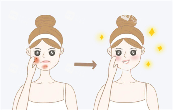 面部祛斑前后对比卡通图