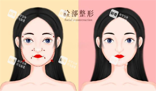 面部轮廓前后对比卡通图展示