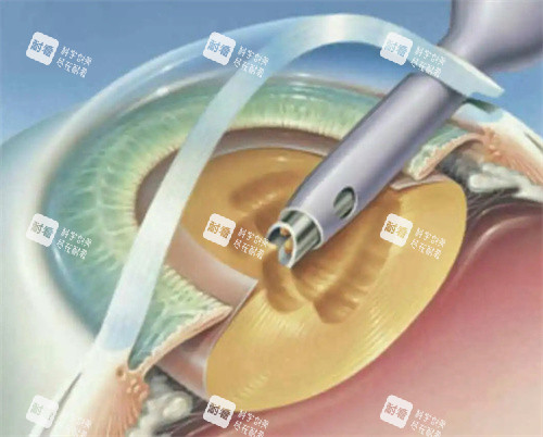 东莞东华医院眼科询问电话，正规眼科热线，可咨询诊疗价格、检查项目