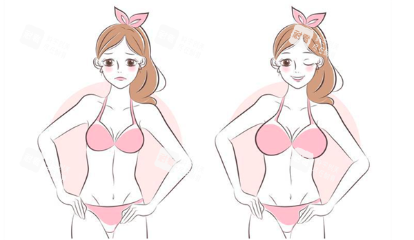 隆胸手术对比
