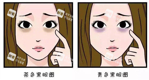 不同的黑眼圈