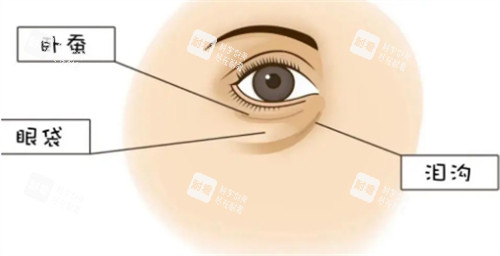 卧蚕眼袋和泪沟位置