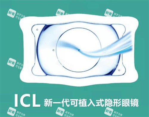 ICL晶体植入