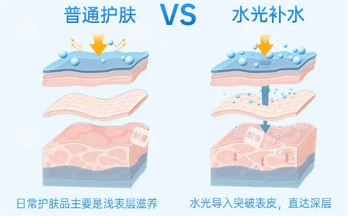 普通补水和水光补水对比