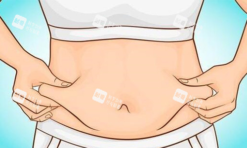 腰腹环吸前动画展示图