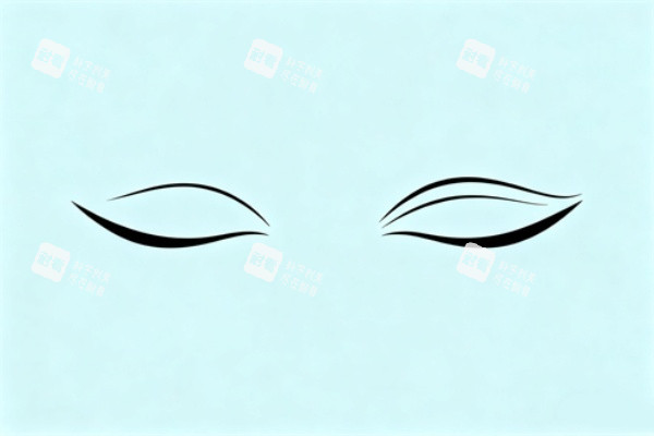 割双眼皮展示图一览