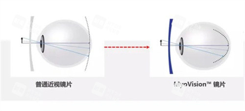 蔡司成长乐镜片原理