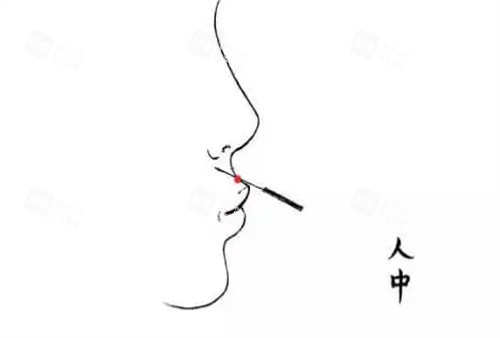 人中加深玻尿酸