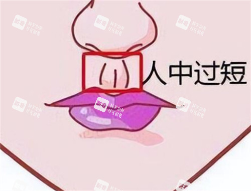 人中过短的样子图片