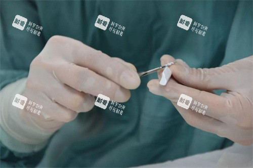 隆鼻手术膨体材料定性演示图