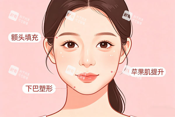 玻尿酸面部提升示意图